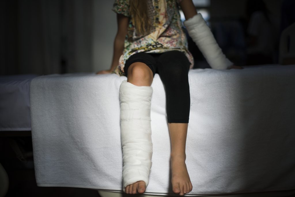 enfant jambe platre